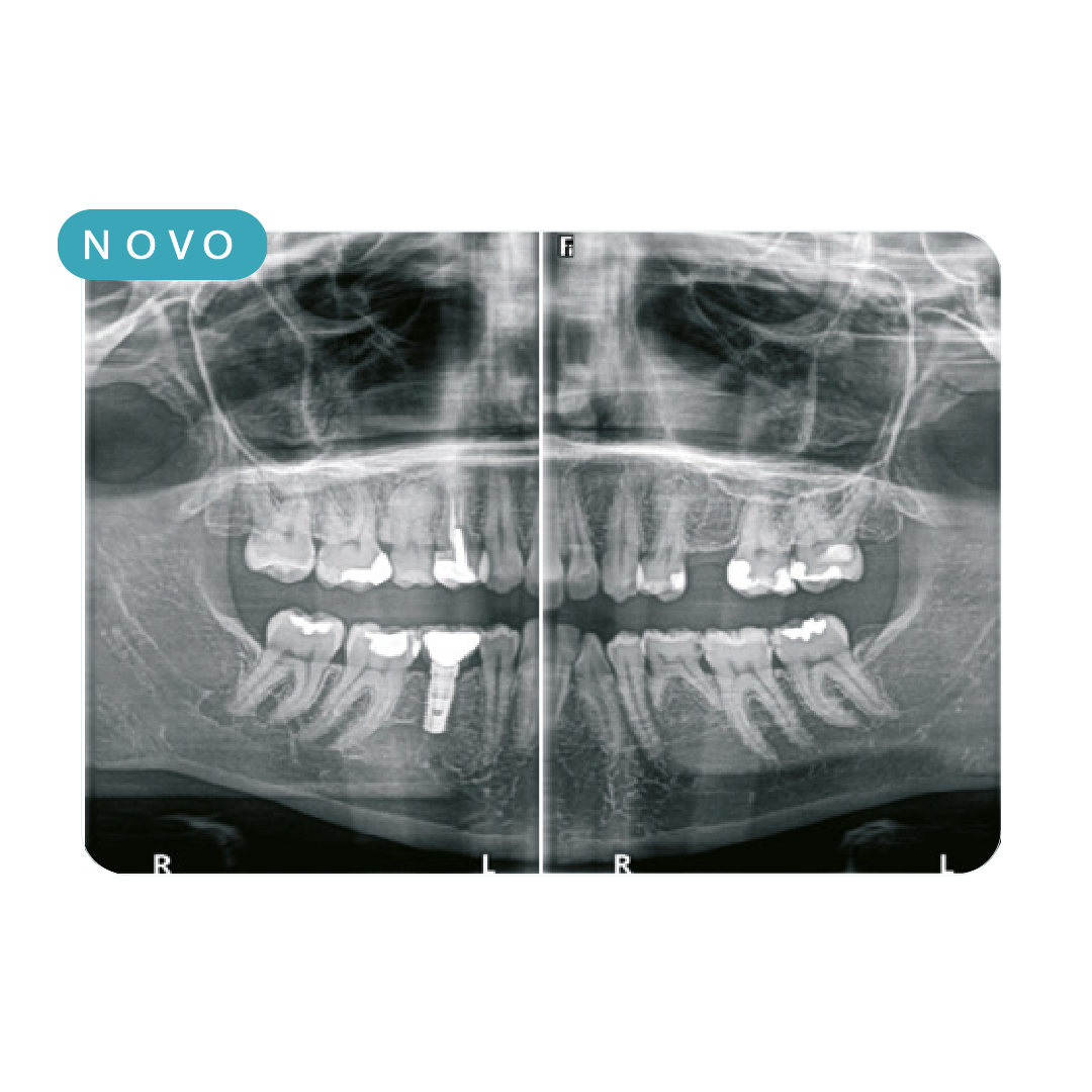 tecnologia exames odontológicos